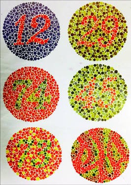 Ishihara Test for Color Blindness Evaluation. Source: ResearchGate
